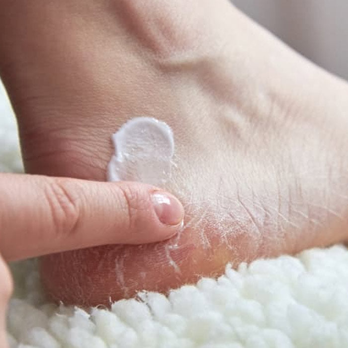Foot Care