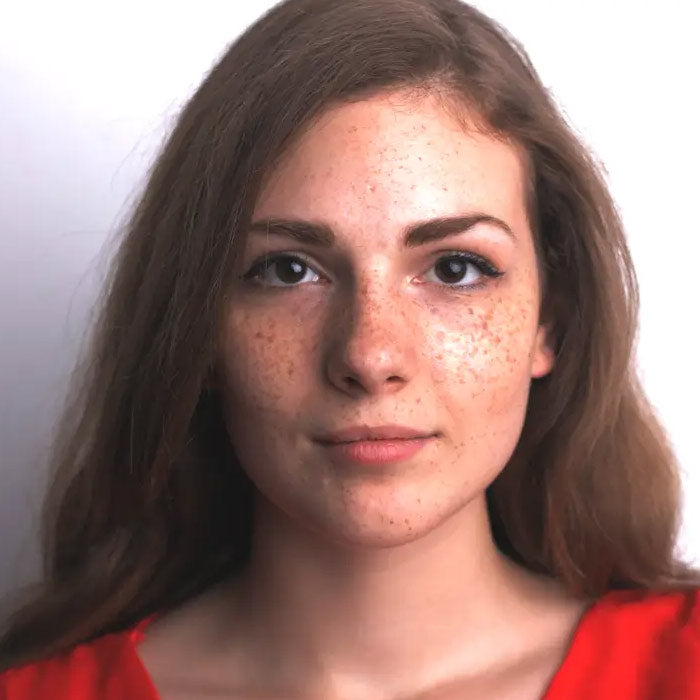 Face Pigmentation