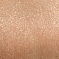 Normal Skin